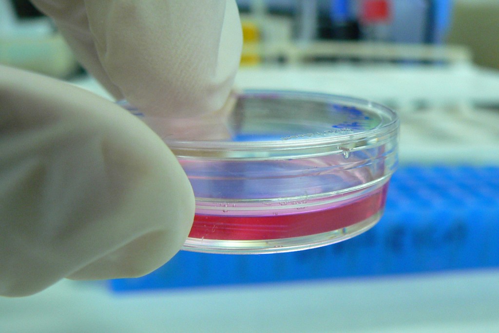 Cell_Culture_in_a_tiny_Petri_dish